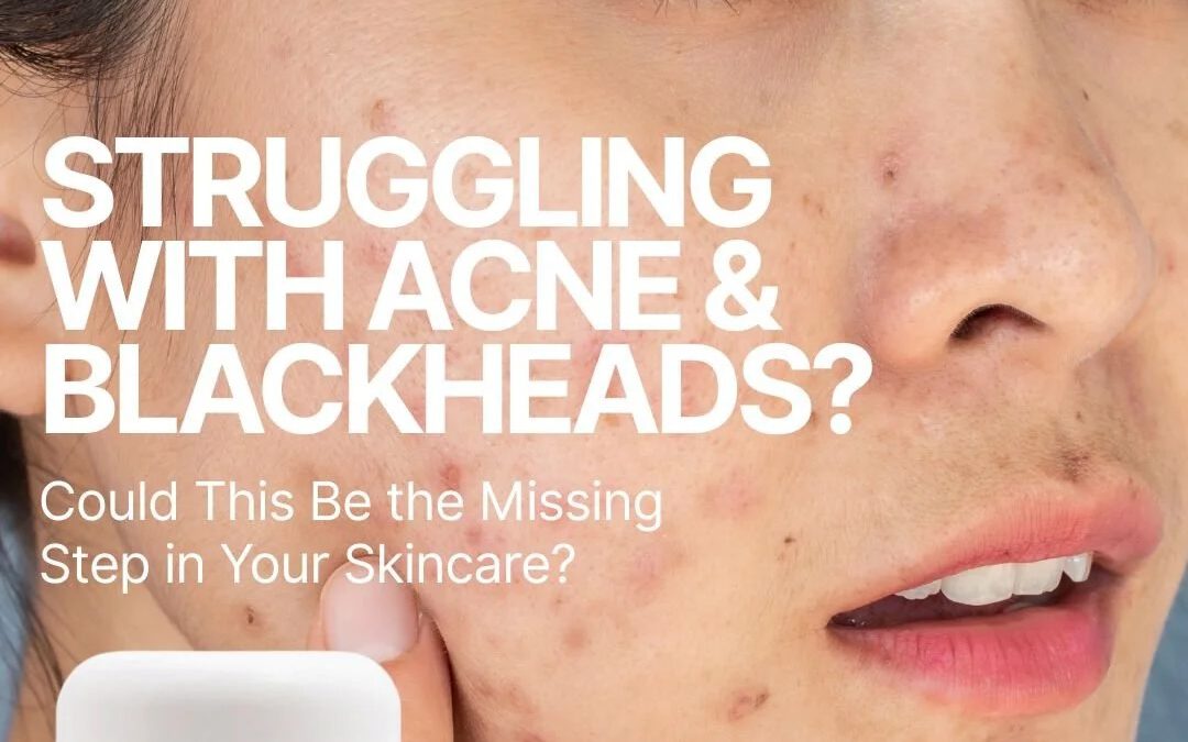 SKIN Therapy Exfoliating Repair