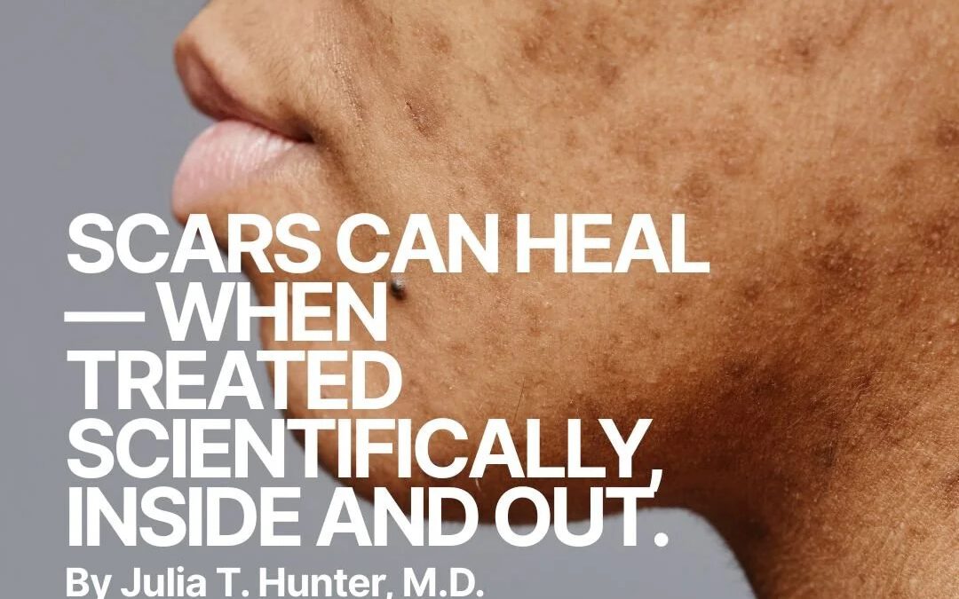 SCARS CAN HEAL-WHEN TREATED SCIENTIFICALLY INSIDE AND OUT