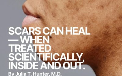 SCARS CAN HEAL-WHEN TREATED SCIENTIFICALLY INSIDE AND OUT